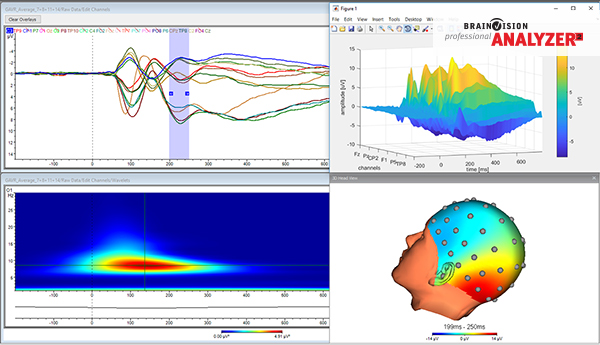 BrainVision analyzer 2 Software